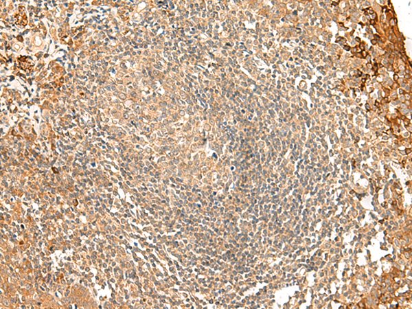 Rabbit Polyclonal Antibody to FNBP1L