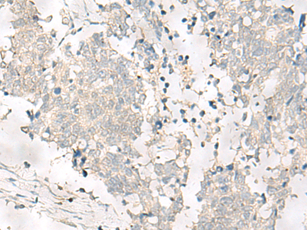 Rabbit Polyclonal Antibody to FNIP2
