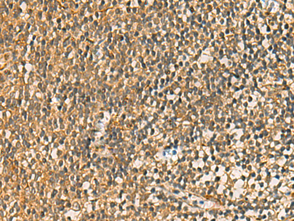 Rabbit Polyclonal Antibody to FAAP100