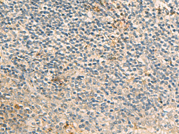 Rabbit Polyclonal Antibody to FRAT1