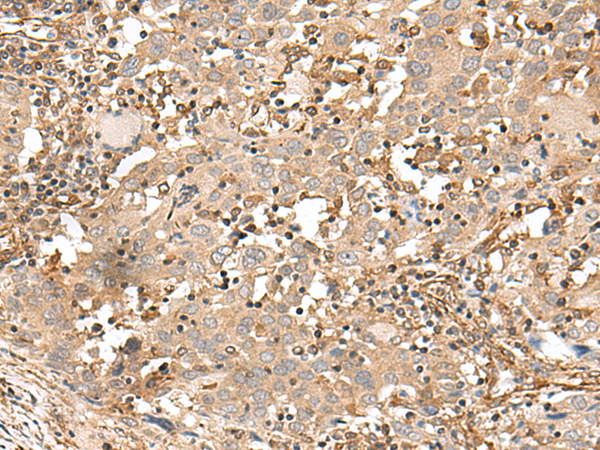 Rabbit Polyclonal Antibody to FSTL5