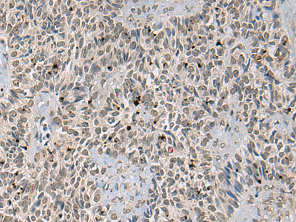 Rabbit Polyclonal Antibody to FUBP1
