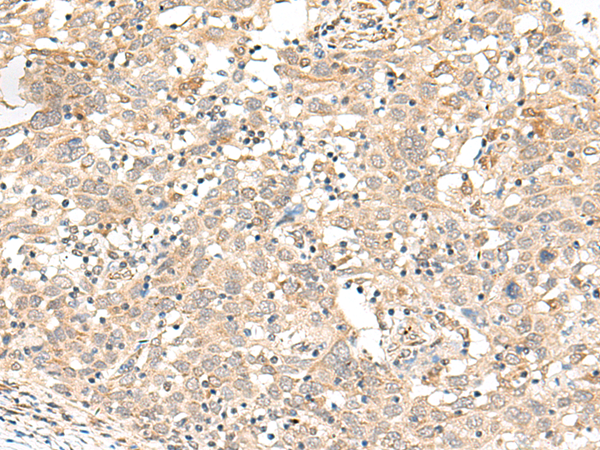 Rabbit Polyclonal Antibody to FUT3