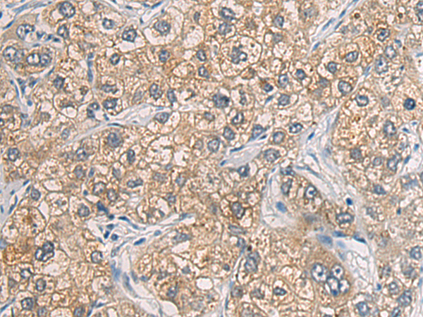 Rabbit Polyclonal Antibody to GAB4