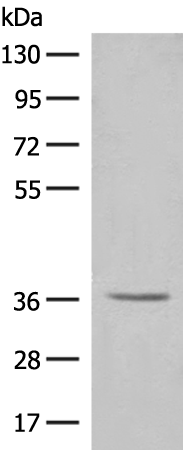 Rabbit Polyclonal Antibody to LGALS4