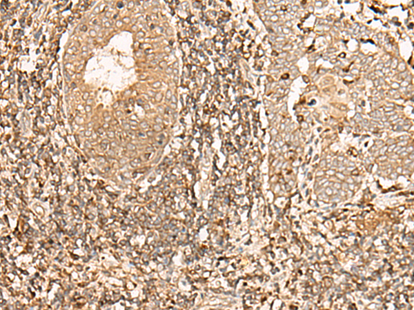 Rabbit Polyclonal Antibody to GALR2