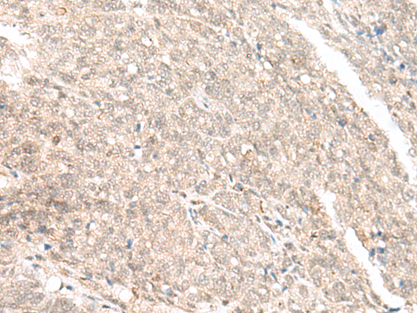 Rabbit Polyclonal Antibody to GANC