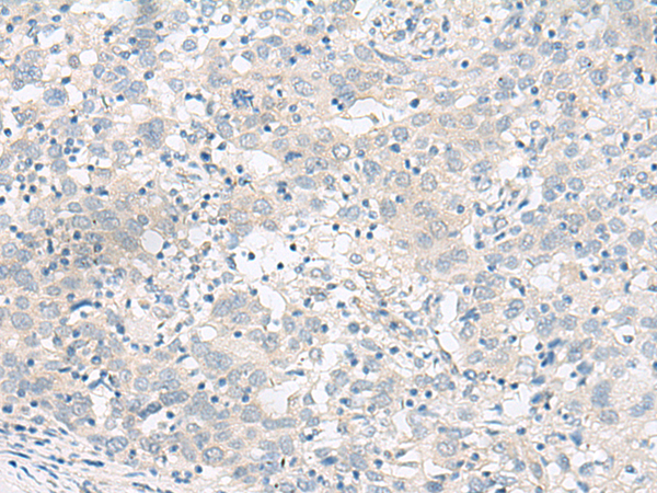 Rabbit Polyclonal Antibody to RALGAPA1