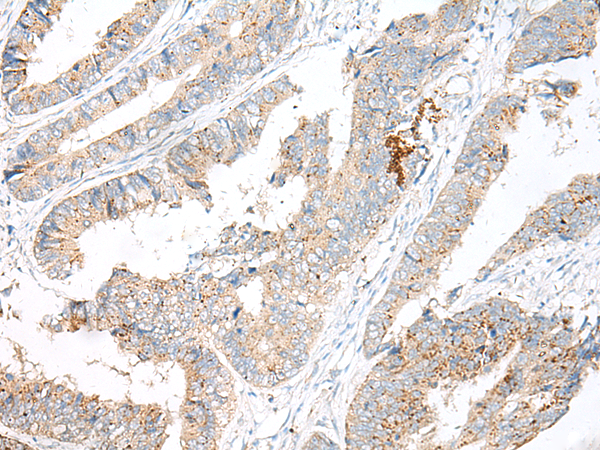 Rabbit Polyclonal Antibody to GARNL3