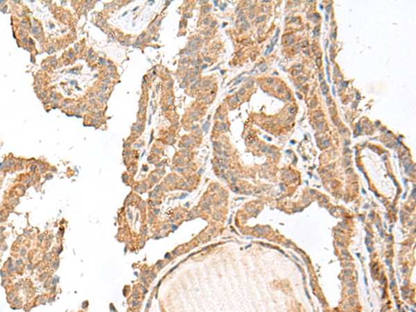 Rabbit Polyclonal Antibody to GART