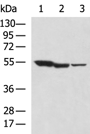 Rabbit Polyclonal Antibody to GBA