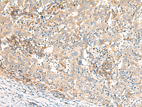 Rabbit Polyclonal Antibody to GBP4