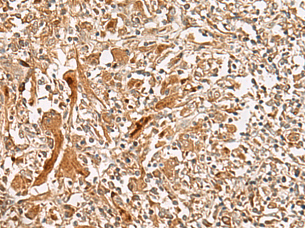 Rabbit Polyclonal Antibody to GCC2