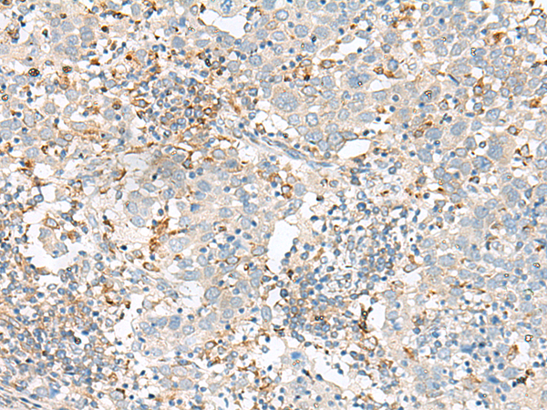 Rabbit Polyclonal Antibody to SLC41A3