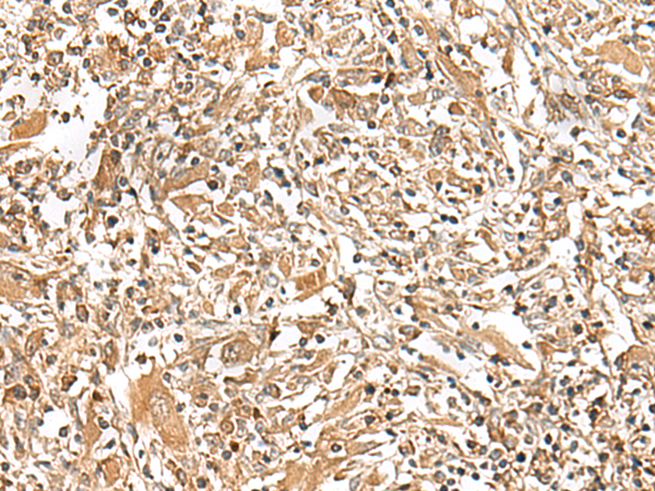 Rabbit Polyclonal Antibody to GEMIN4