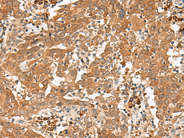 Rabbit Polyclonal Antibody to GFI1