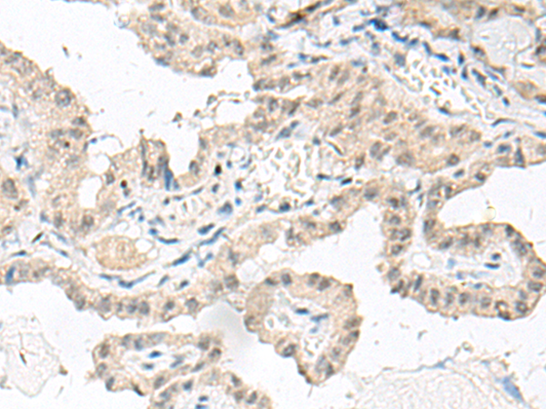 Rabbit Polyclonal Antibody to GFI1B