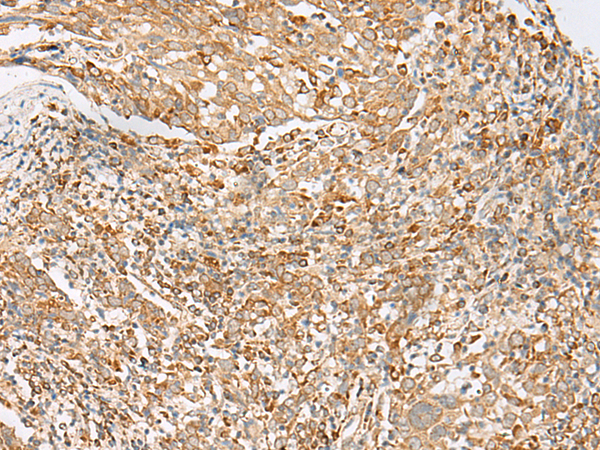 Rabbit Polyclonal Antibody to MBOAT4