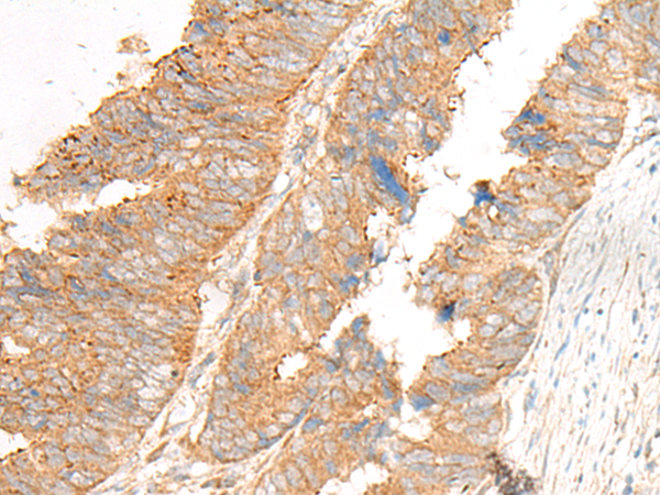 Rabbit Polyclonal Antibody to GLIS1