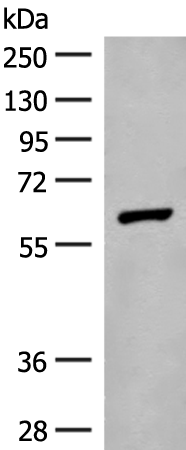 Rabbit Polyclonal Antibody to GLS2