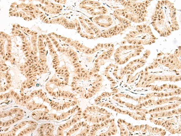 Rabbit Polyclonal Antibody to BICRA