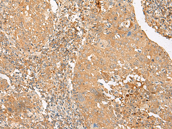 Rabbit Polyclonal Antibody to SLC2A8