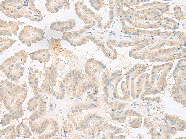 Rabbit Polyclonal Antibody to EPRS1