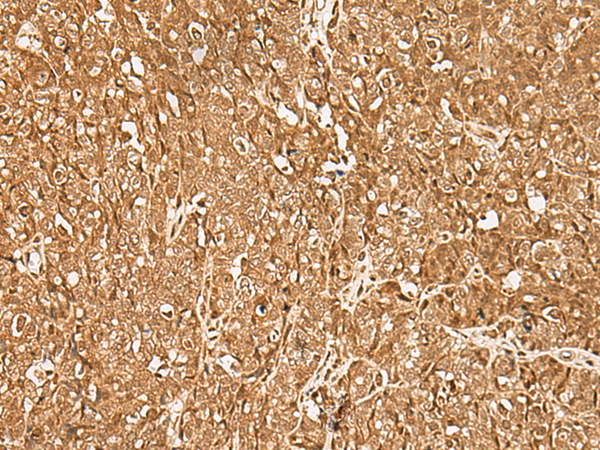 Rabbit Polyclonal Antibody to GMEB2