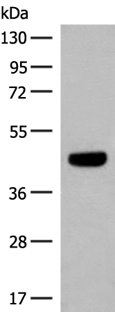 Rabbit Polyclonal Antibody to GNAT1