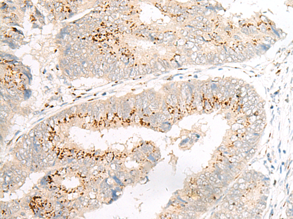Rabbit Polyclonal Antibody to GOLIM4