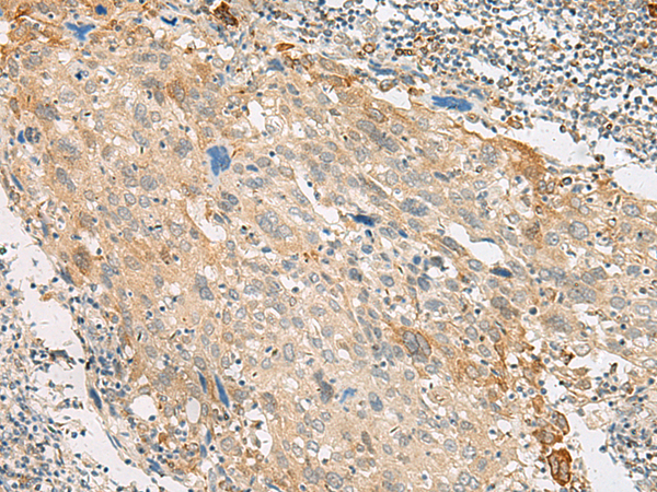 Rabbit Polyclonal Antibody to GPR151