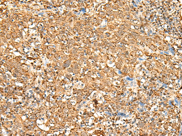 Rabbit Polyclonal Antibody to P2RY14