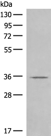 Rabbit Polyclonal Antibody to GPR119
