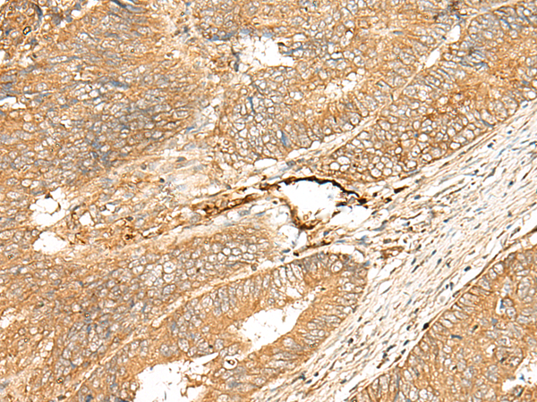 Rabbit Polyclonal Antibody to ADGRF5