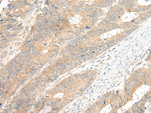 Rabbit Polyclonal Antibody to GPR12