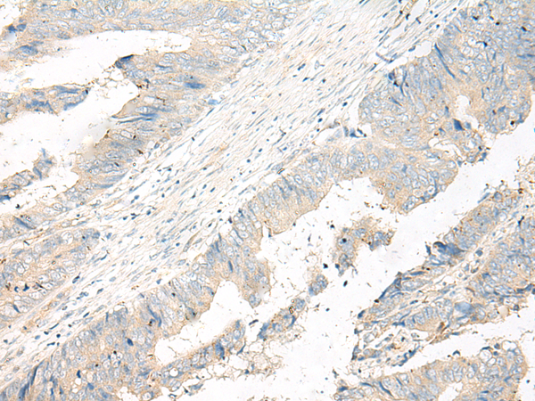 Rabbit Polyclonal Antibody to ADGRG6