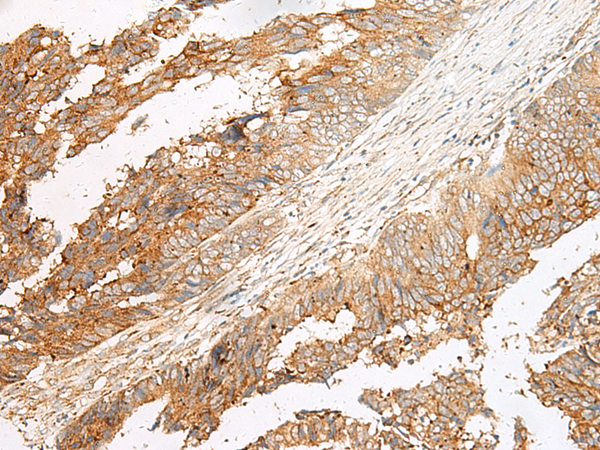 Rabbit Polyclonal Antibody to GPR17
