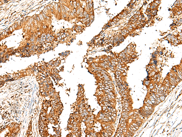 Rabbit Polyclonal Antibody to GPR21
