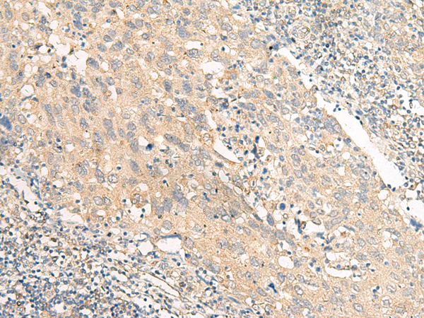 Rabbit Polyclonal Antibody to CHP1