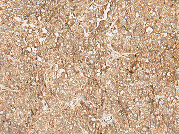 Rabbit Polyclonal Antibody to SNAPC5