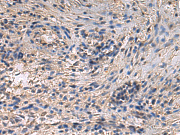 Rabbit Polyclonal Antibody to GNG3