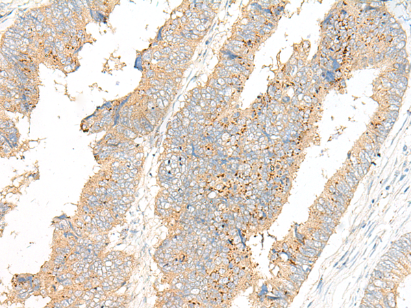Rabbit Polyclonal Antibody to MSRB1