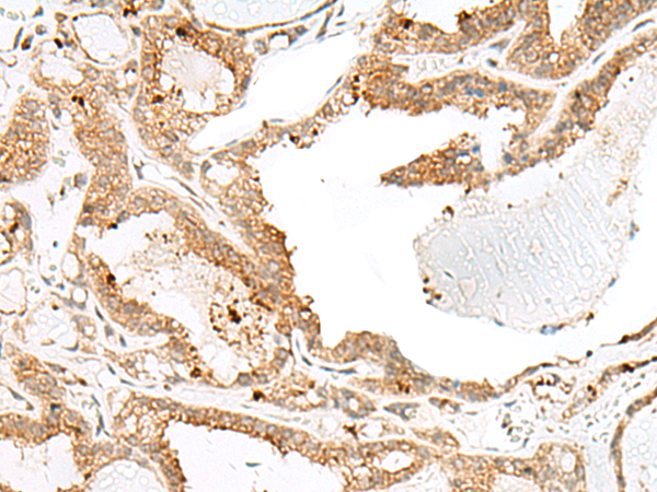 Rabbit Polyclonal Antibody to ENAH