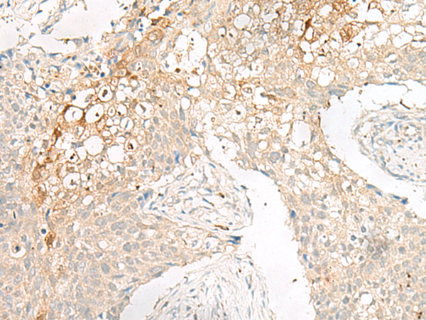 Rabbit Polyclonal Antibody to GPR78