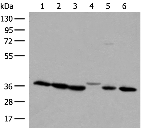 Rabbit Polyclonal Antibody to LDHA