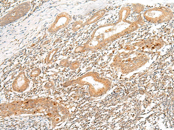 Rabbit Polyclonal Antibody to HLA-G