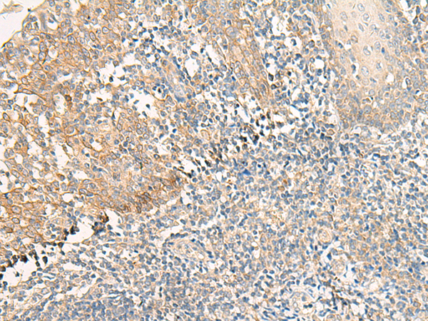 Rabbit Polyclonal Antibody to GPR35