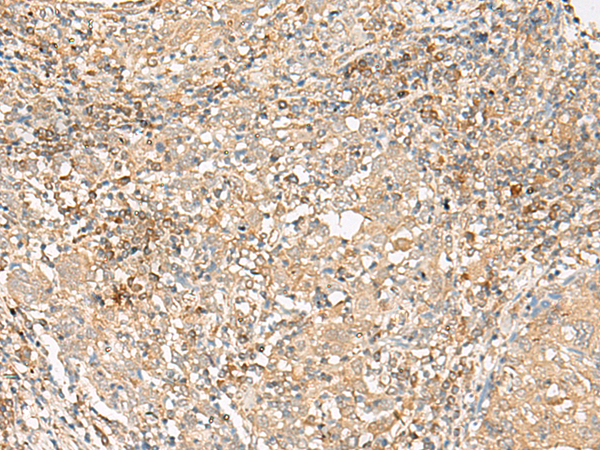 Rabbit Polyclonal Antibody to FFAR2