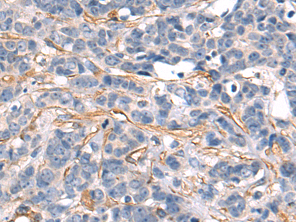 Rabbit Polyclonal Antibody to PTGDR2