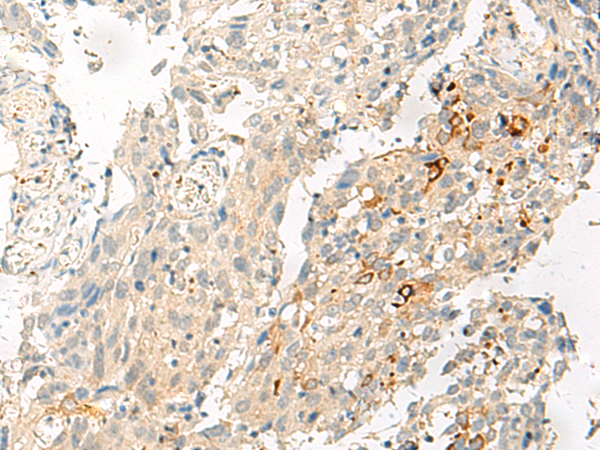 Rabbit Polyclonal Antibody to ADGRG1